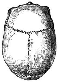438. Dolichokephalie.